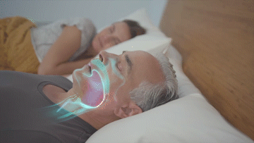 man's snore airway animation improved with smart nora motion